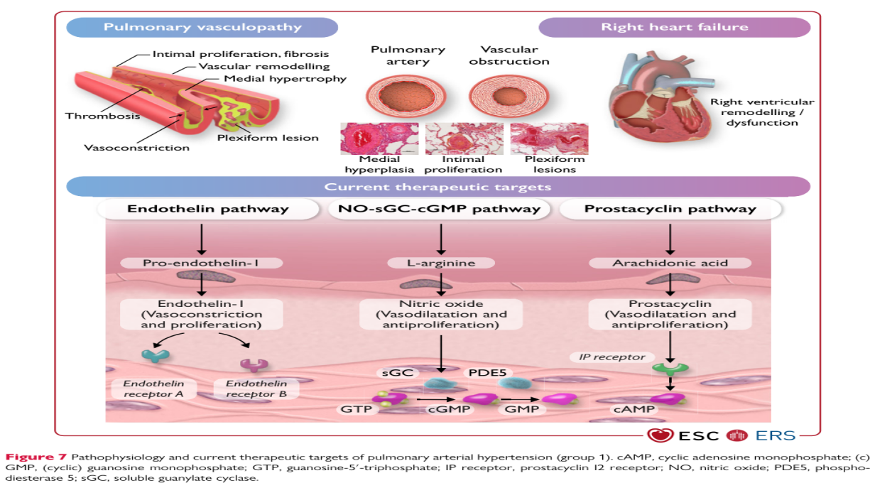 bosentan-for-treat-pulmonary-arterial-hypertension-0